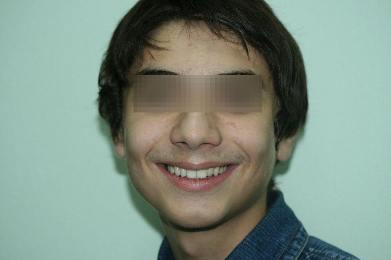Рамиз, 12 лет